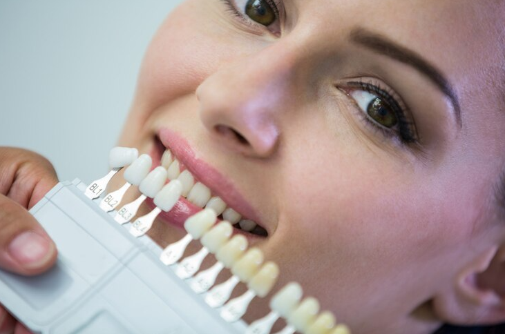 Aesthetic Dental Prosthetics: Solutions that Perfect Your Smile